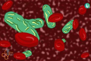 عفونت خون و سپسیس چیست ؟ علائم و درمان