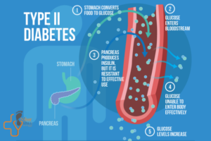 دیابت نوع 2 ( علائم و عوارض آن )