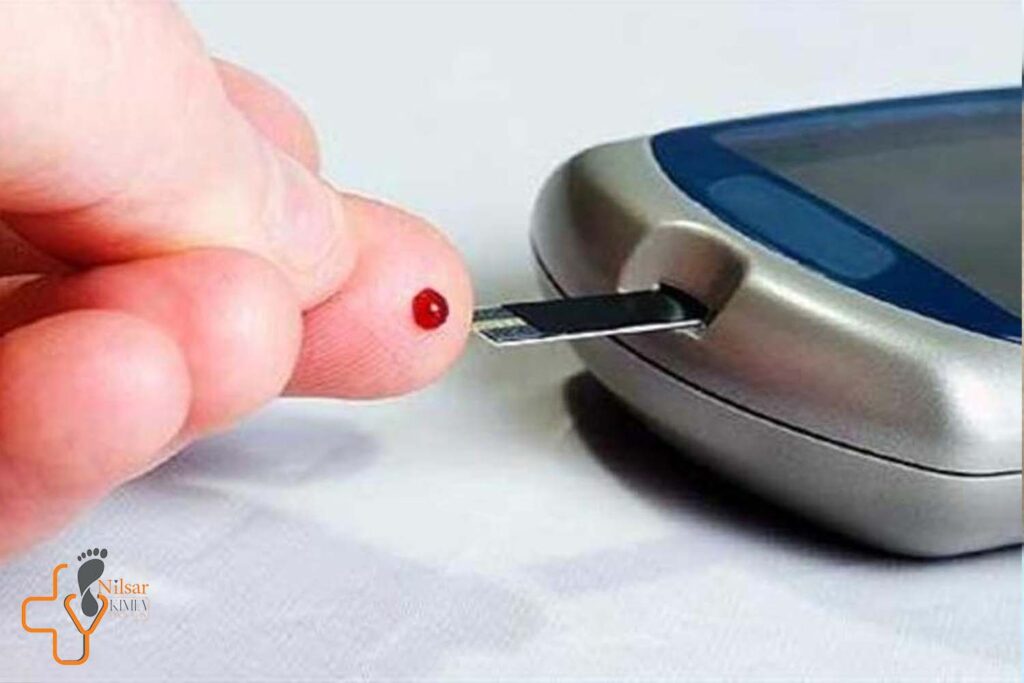 نقش ایمونوتراپی در درمان زخم های دیابتی