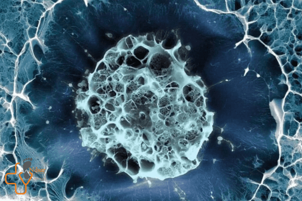 نقش سلولهای بنیادی در درمان زخم دیابتی