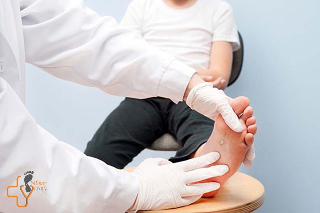 درمان قطعی زخم پای دیابتی در طب سنتی