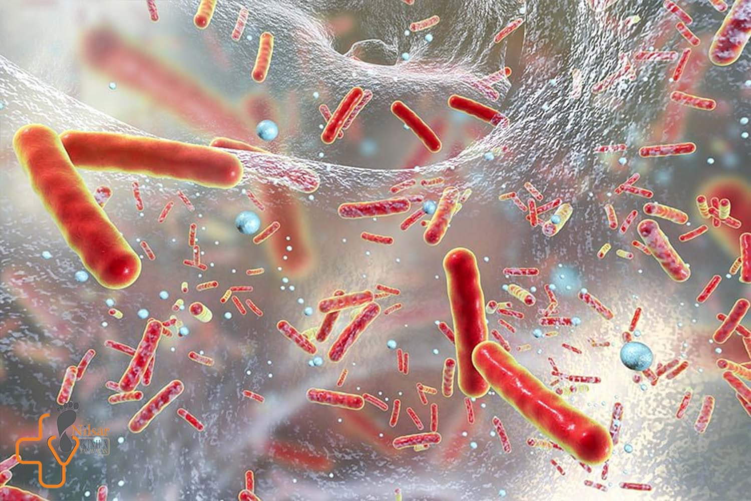 پتانسیل باکتری‌درمانی در درمان زخم‌های مقاوم دیابتی