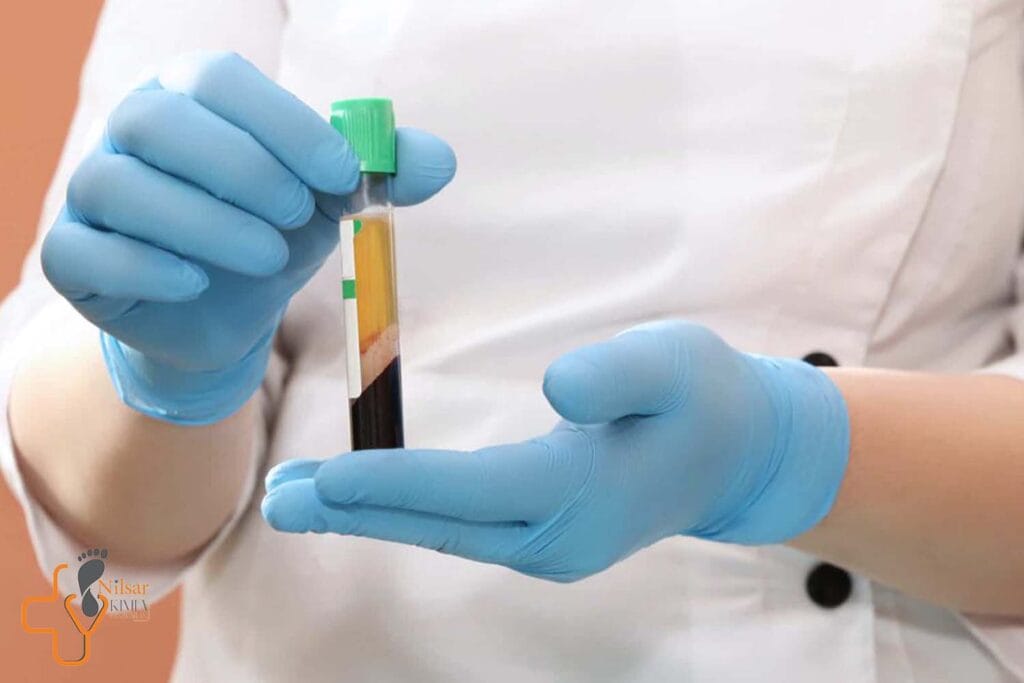 نقش پلاسمای غنی از پلاکت (PRP) در درمان زخم‌های دیابتی