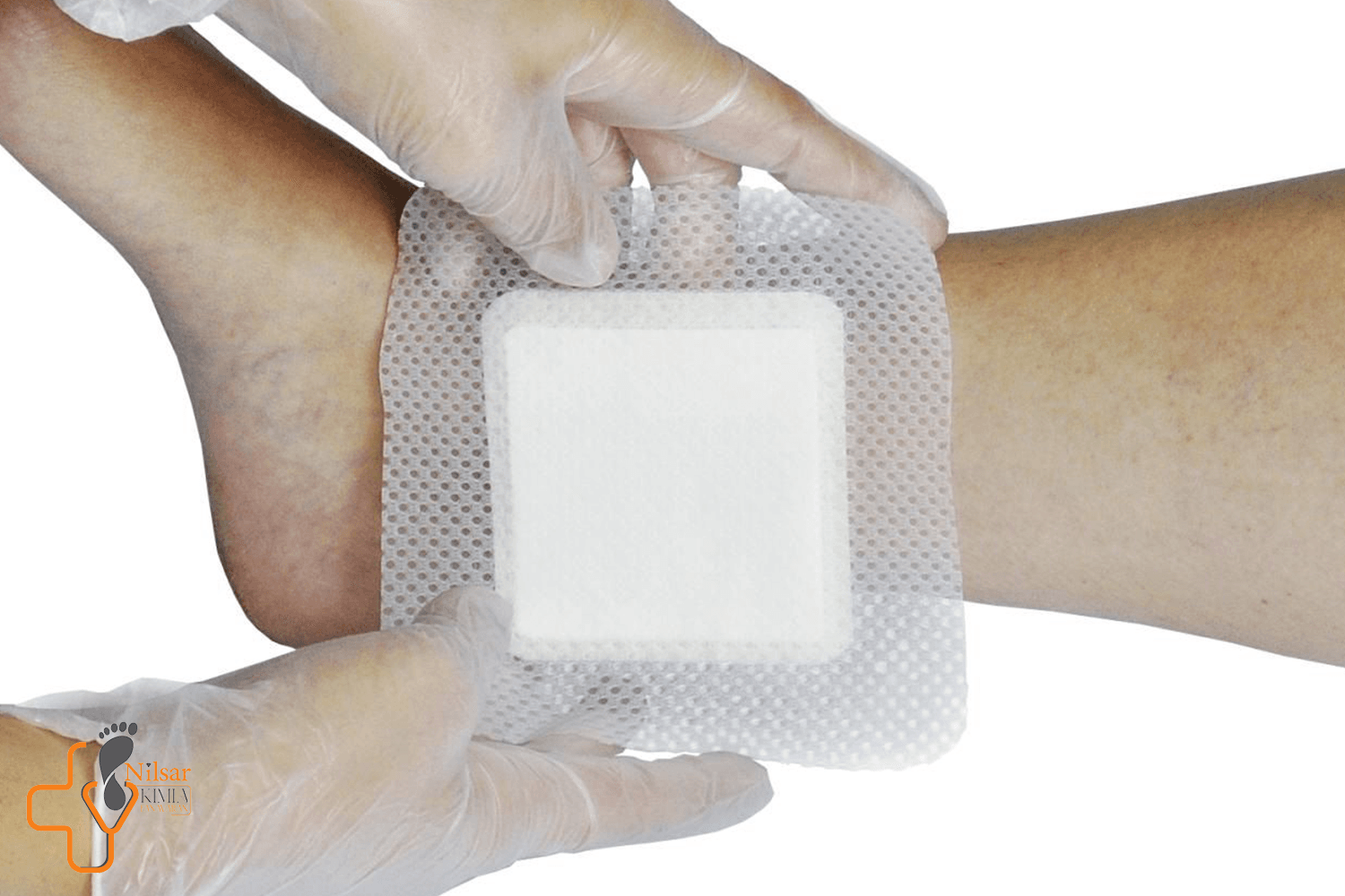 نحویه شست شو و پانسمان زخم دیابتی