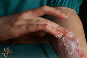 چرا زخم سوختگی خوب نمی شود؟