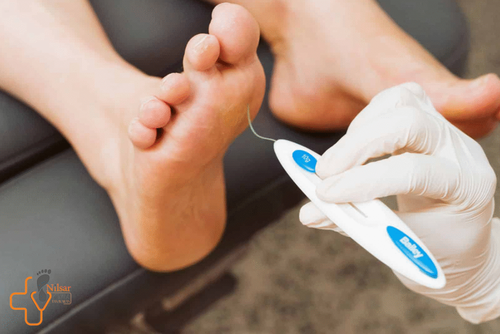 آزمایش نوروپاتی