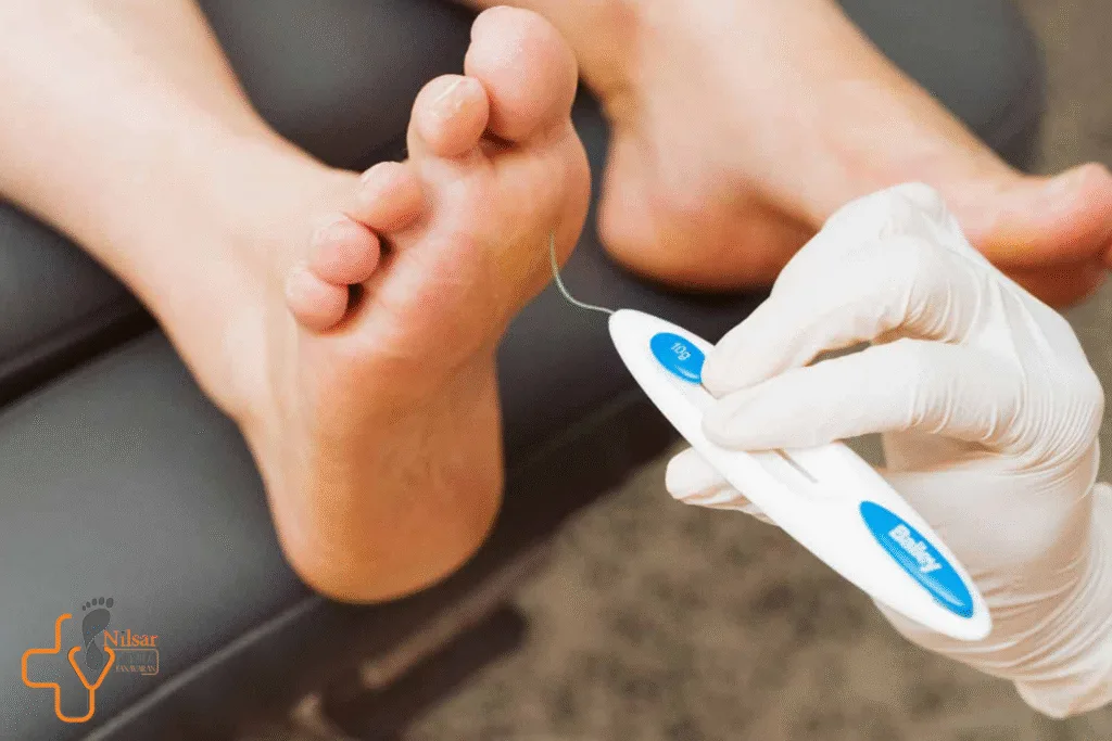 آزمایش نوروپاتی