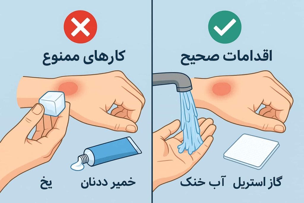 «مقایسه کارهای ممنوع و اقدامات صحیح در برخورد اولیه با سوختگی»